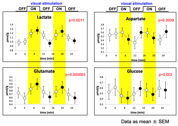 MR Spectroscopy and Metabolism Billede2